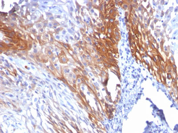 Cytokeratin 17 (KRT17) (Basal Epithelial Marker) Antibody - With BSA and Azide