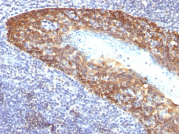 Cytokeratin 14 (KRT14) (Squamous Cell Marker) Antibody - With BSA and Azide