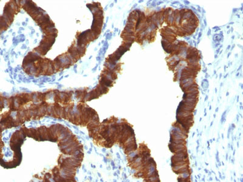Cytokeratin 7 (KRT7) (Glandular and Transitional Epithelial Marker) Antibody - With BSA and Azide