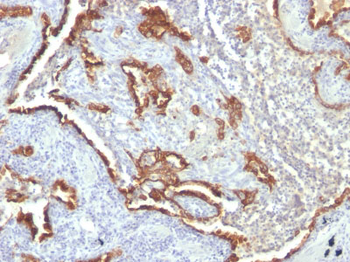 Cytokeratin 7 (KRT7) (Glandular and Transitional Epithelial Marker) Antibody - With BSA and Azide