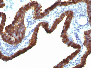 Cytokeratin 7 (KRT7) (Glandular and Transitional Epithelial Marker) Antibody - With BSA and Azide