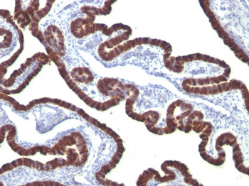 Cytokeratin 7 (KRT7) (Glandular and Transitional Epithelial Marker) Antibody - With BSA and Azide