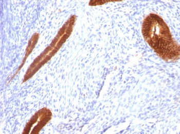 Cytokeratin 7 (KRT7) (Glandular and Transitional Epithelial Marker) Antibody - With BSA and Azide