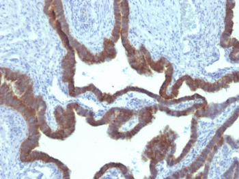 Cytokeratin 7 (KRT7) (Glandular and Transitional Epithelial Marker) Antibody - With BSA and Azide