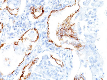 Cytokeratin 7 (KRT7) (Glandular and Transitional Epithelial Marker) Antibody - With BSA and Azide