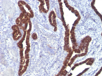Cytokeratin 7 (KRT7) (Glandular and Transitional Epithelial Marker) Antibody - With BSA and Azide