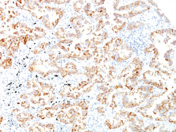 Cytokeratin 7 (KRT7) (Glandular and Transitional Epithelial Marker) Antibody - With BSA and Azide