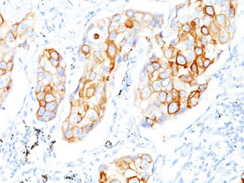 Cytokeratin 7 (KRT7) (Glandular and Transitional Epithelial Marker) Antibody - With BSA and Azide