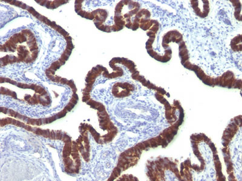 Cytokeratin 7 (KRT7) (Glandular and Transitional Epithelial Marker) Antibody - With BSA and Azide