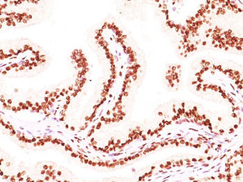 Androgen Receptor (Marker of Androgen Dependence) Antibody - With BSA and Azide