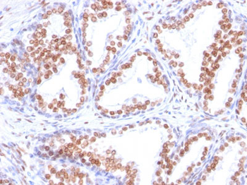 Androgen Receptor (Marker of Androgen Dependence) Antibody - With BSA and Azide