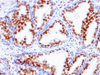 Androgen Receptor (Marker of Androgen Dependence) Antibody - With BSA and Azide
