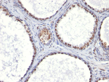 Androgen Receptor (Marker of Androgen Dependence) Antibody - With BSA and Azide