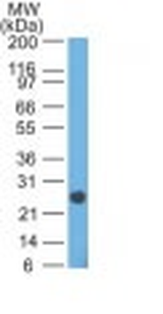 Lambda Light Chain (B-Cell Marker) Antibody - With BSA and Azide