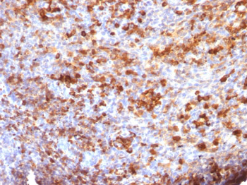 IgG (Immunoglobulin Gamma Heavy Chain) (B-Cell Marker) Antibody - With BSA and Azide