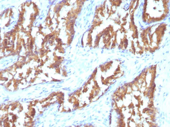 IDH1 (Isocitrate Dehydrogenase) Antibody - With BSA and Azide
