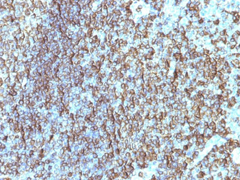 HLA-DRB (MHC II) Antibody - With BSA and Azide