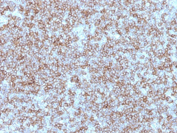 HLA-DP/-DR (MHC II) Antibody - With BSA and Azide