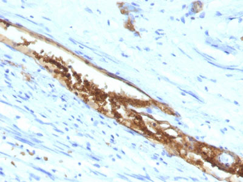 Blood Group Antigen A (CD173) Antibody - With BSA and Azide