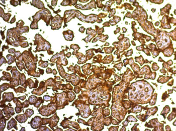 Placental Alkaline Phosphatase (PLAP) (Germ Cell Tumor Marker) Antibody - With BSA and Azide