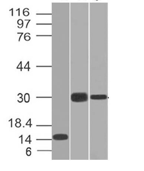 CELA3B / ELA3B (Pancreatic Function Marker) Antibody - With BSA and Azide