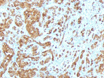 MART-1 / Melan-A / MLANA (Melanoma Marker) Antibody - With BSA and Azide