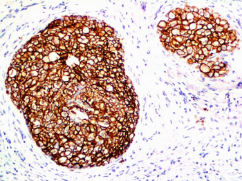 HER-2 / c-erbB-2 / neu / CD340 Antibody - With BSA and Azide