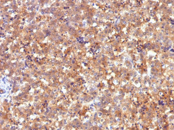 AFP (Alpha Fetoprotein) (Hepatocellular/Germ Cell Tumor Marker) Antibody - With BSA and Azide