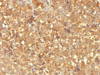 AFP (Alpha Fetoprotein) (Hepatocellular/Germ Cell Tumor Marker) Antibody - With BSA and Azide