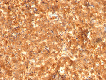 AFP (Alpha Fetoprotein) (Hepatocellular/Germ Cell Tumor Marker) Antibody - With BSA and Azide