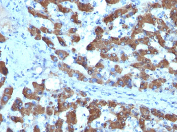 CPS1 / Carbamoyl-Phosphate Synthetase (Hepatocellular Marker) Antibody - With BSA and Azide