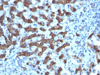 CPS1 / Carbamoyl-Phosphate Synthetase (Hepatocellular Marker) Antibody - With BSA and Azide