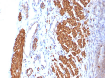 Calponin-1 (Smooth Muscle Marker) Antibody - With BSA and Azide