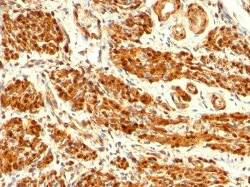 Calponin-1 (Smooth Muscle Marker) Antibody - With BSA and Azide