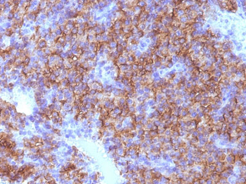 Chromogranin A / CHGA (Neuroendocrine Marker) Antibody - With BSA and Azide