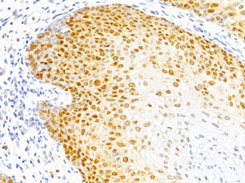 p27Kip1 (Mitotic Inhibitor/Suppressor Protein) Antibody - With BSA and Azide