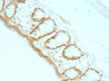 p27Kip1 (Mitotic Inhibitor/Suppressor Protein) Antibody - With BSA and Azide