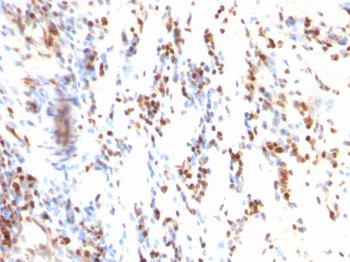 p27Kip1 (Mitotic Inhibitor/Suppressor Protein) Antibody - With BSA and Azide