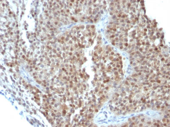 p21WAF1 (Tumor Suppressor Protein) Antibody - With BSA and Azide