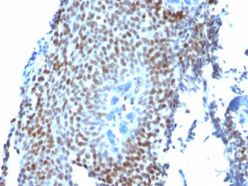 p21WAF1 (Tumor Suppressor Protein) Antibody - With BSA and Azide