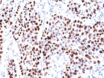 p21WAF1 (Tumor Suppressor Protein) Antibody - With BSA and Azide