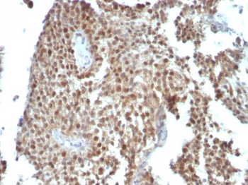 p21WAF1 (Tumor Suppressor Protein) Antibody - With BSA and Azide
