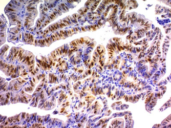 p21WAF1 (Tumor Suppressor Protein) Antibody - With BSA and Azide