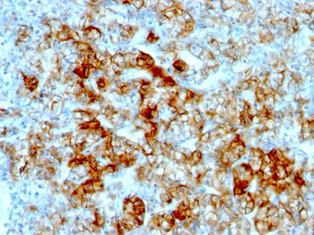 Ksp-Cadherin (Kidney-Specific Cadherin) / CDH16 Antibody - With BSA and Azide