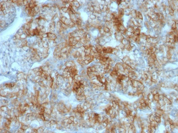 Ksp-Cadherin (Kidney-Specific Cadherin) / CDH16 Antibody - With BSA and Azide