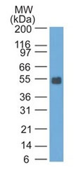 Ep-CAM / CD326 (Rat) (Epithelial Marker) Antibody - Bioreactor Concentrate