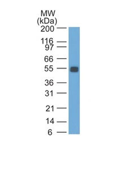 Ep-CAM / CD326 (Rat) (Epithelial Marker) Antibody - Bioreactor Concentrate