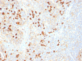 Plasma Cell Marker Antibody - With BSA and Azide
