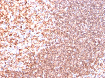 CD74 (B-Cell Marker) Antibody - With BSA and Azide