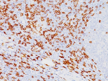CD8A (Cytotoxic- & Suppressor T-Cell Marker) Antibody - With BSA and Azide